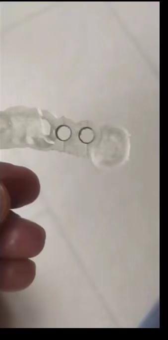 Panduan tanam Printer gigi 3D  - 3D Printing Dental ulasan dan harga