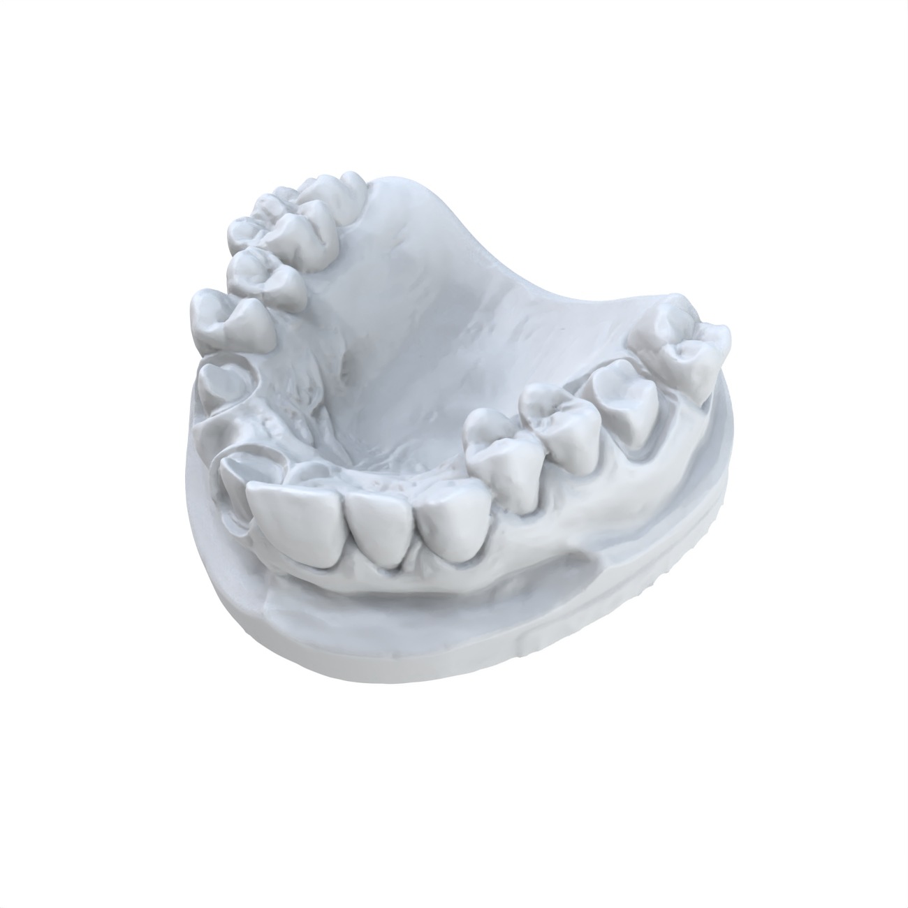 1 Buah Model Gigi Bahan Resin  - 3D Printing Dental ulasan dan harga