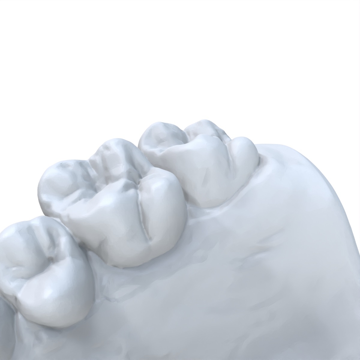 1 Buah Model Gigi Bahan Resin  - 3D Printing Dental ulasan dan harga